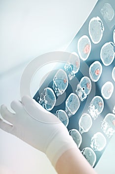 CT scan in the bright light of the medical hospital