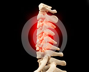 CT scan of C-Spine or Cervical spine 3D rendering