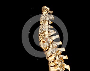 CT SCAN of Cervical Spine ( C-spine )  3D rendering image