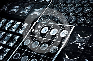 CT scan and MRI images