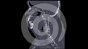 A CT scan of the neck sagittal view for diagnostic technique is essential for evaluating cervical vertebrae, soft tissues, and