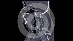 A CT scan of the neck sagittal view for diagnostic technique is essential for evaluating cervical vertebrae, soft tissues, and