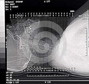 CT Scan Scout