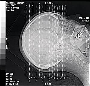 CT Scan Scout 7