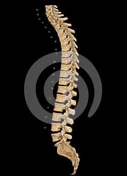 CT scan of Whole spine 3D rendering showing Profile Human Spine