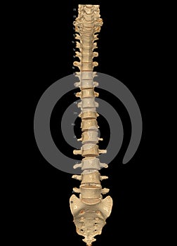 CT scan of Whole spine 3D rendering showing Profile Human Spine