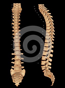 CT scan of Whole spine 3D rendering showing Profile Human Spine