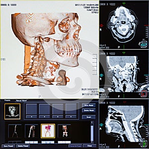 CT scans of human head photo