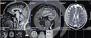 CT scans of human head photo