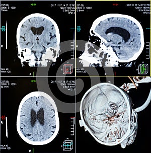 CT scans of human head photo