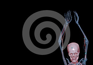 CTA brachial artery or CT scan of upper extremity or the Arm 3d rendering image on black background photo
