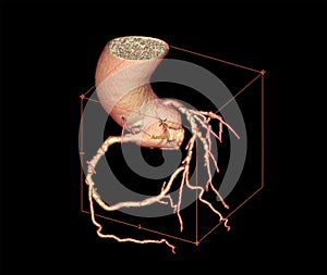CTA Coronary artery  3D rendering image