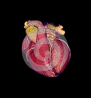 CTA Coronary artery  3D rendering image.