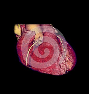 CTA Coronary artery  3D rendering image .