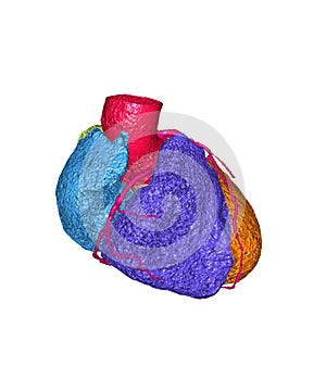 CTA Coronary artery 3D rendering image