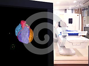 CTA Coronary artery 3D rendering image on the mornitor in CT Scanner room