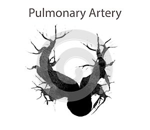 CTA pulmonary arteries