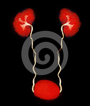 CTA Renal artery  3D rendering image  showing both kidney, Ureter and bladder