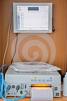 CTG device with monitoring of the state of health of the mother and child during childbirth in the hospital. Cardiotocograph