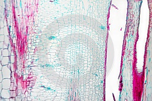 Cucurbits Stem- cell microscopic photo