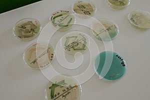 Culture of bacteria such as E Coli in a container for scientific research