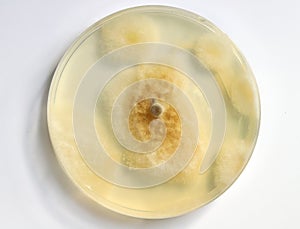 Culture on nutrient agar petri dish including yeasts and fungi.