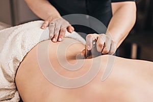 Cupping back massage - close-up of a masseurÃ¢â¬â¢s hand with a vacuum jar - deep muscle stimulation