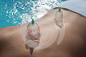 Cupping therapy, spa,on the patient's back at spa center