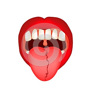 Curvature of the midline of the tongue. Definition of a disease according to human tongue. Diagnostics by tongue. Tongue