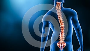 Curvature of the spine and man body back view 3D rendering illustration with copy space. Spine disorder or deformity, scoliosis,