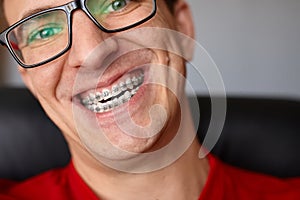 Curved teeth of guy with braces in glasses close up. Portrait of