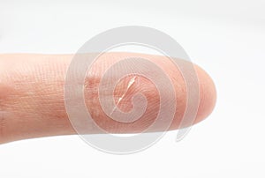 Cut on the finger.Human skin texture background. Macro photo, close up