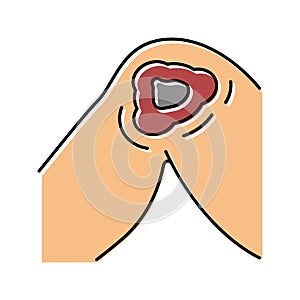 cutaneous mucormycosis color icon vector illustration