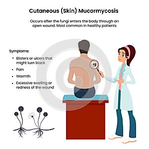 Cutaneous Mucormycosis vector illustration informational graphic