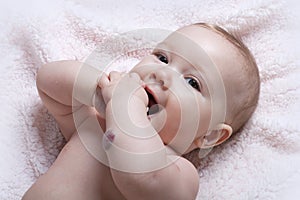 Cute baby girl with hemangioma photo
