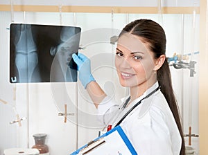 Cute beautiful female doctor in white coat with roentgen in hands photo