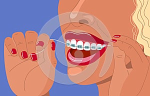 Cute blonde young woman with braces uses dental floss. Daily dental care. Correction of bite and a beautiful smile