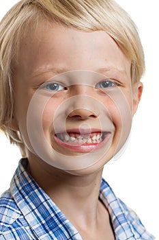 Cute boy with missing front teeth