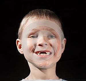 Cute boy missing some front teeth