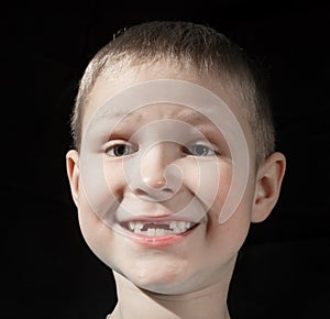 Cute boy missing some front teeth