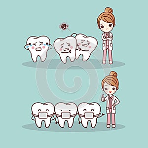 Cute cartoon tooth braces photo