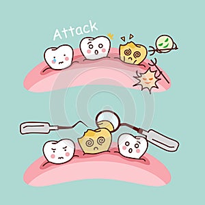 Cute cartoon tooth cavity