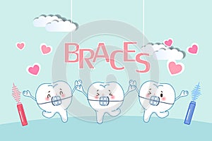 Cute cartoon tooth wear brace