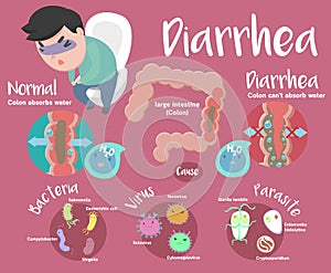 Cute Diarrhea infographic photo