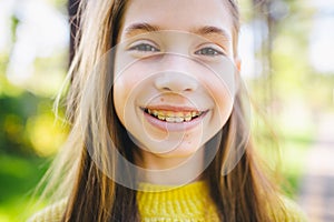 Cute and happy teen girl with braces smiling to camera in yellow clothes in park. Concept of dentist and orthodontist