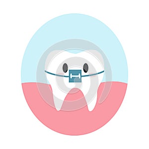 Cute healthy tooth with braces in cartoon flat style. Vector illustration of healthy teeth character, orthodontic fixed