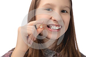 A cute little girl holds a recently removed molar in her hand and shows the place from which this tooth was removed