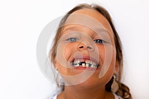 Cute little girl with open toothless mouth with temporary milk spacing teeth. Caries decay, orthodontal care and hygiene