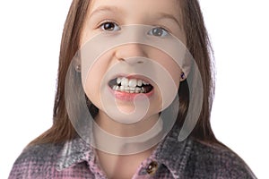 A cute little girl shows an orthodontic appliance in her mouth. The concept of teeth alignment in childhood. Studio photo on a