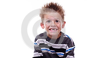 Cute young boy smiling and missing teeth